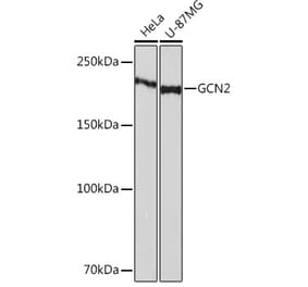 Western Blot - Anti-GCN2 Antibody [ARC52336] (A306894) - Antibodies.com