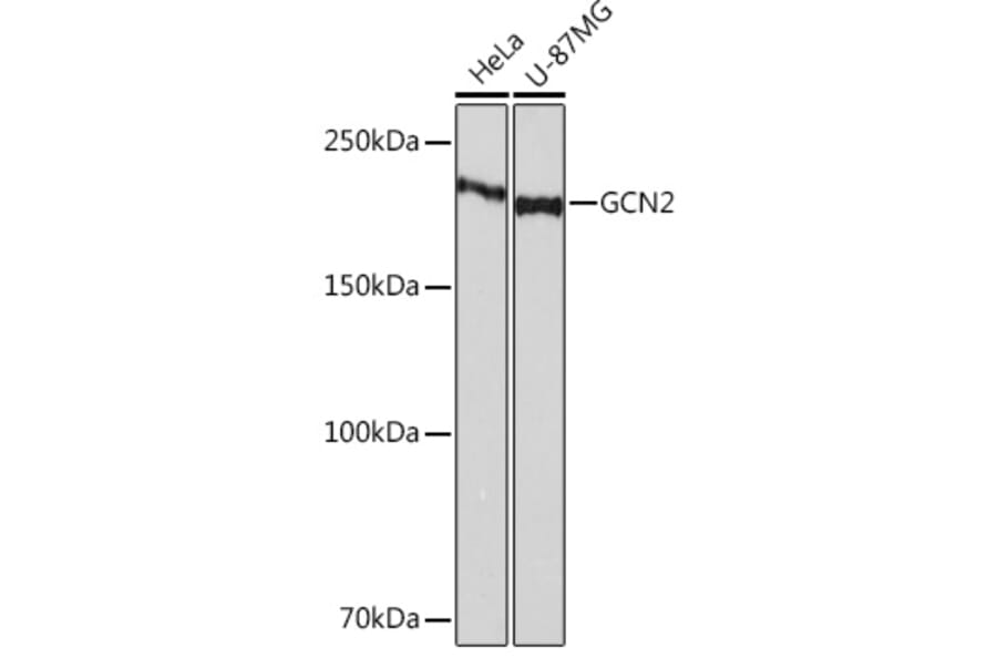 Western Blot - Anti-GCN2 Antibody [ARC52336] (A306894) - Antibodies.com