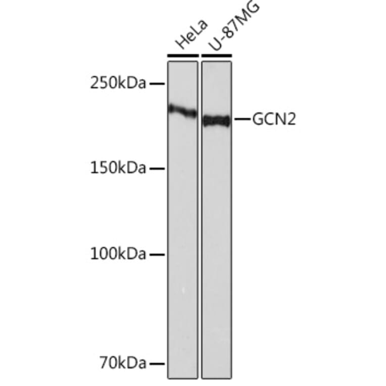 Western Blot - Anti-GCN2 Antibody [ARC52336] (A306894) - Antibodies.com