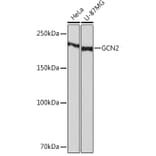 Western Blot - Anti-GCN2 Antibody [ARC52336] (A306894) - Antibodies.com