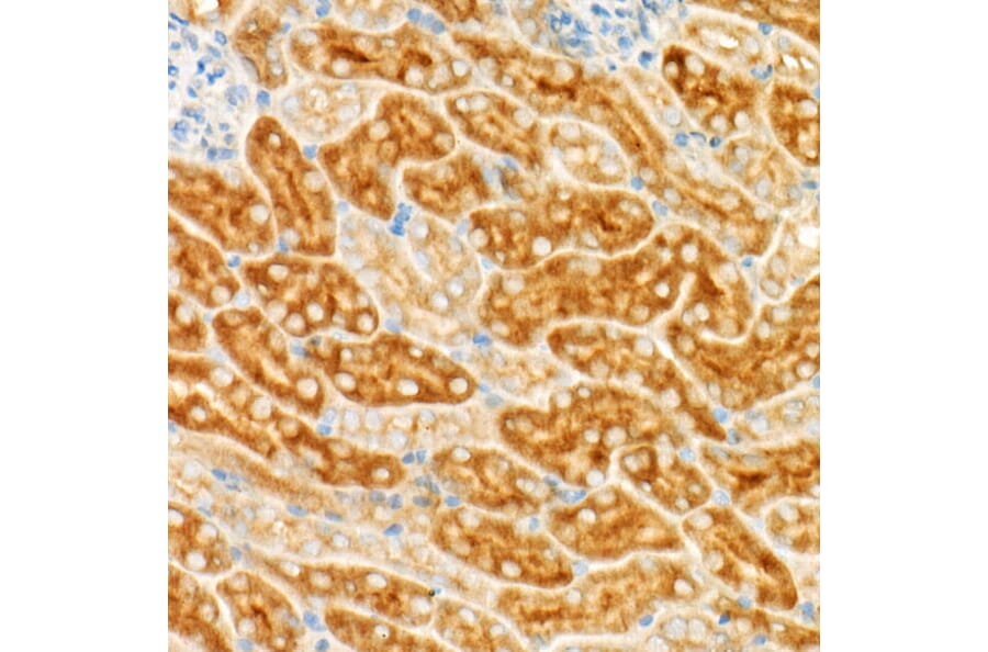 Immunohistochemistry - Anti-GCN2 Antibody [ARC52336] (A306894) - Antibodies.com