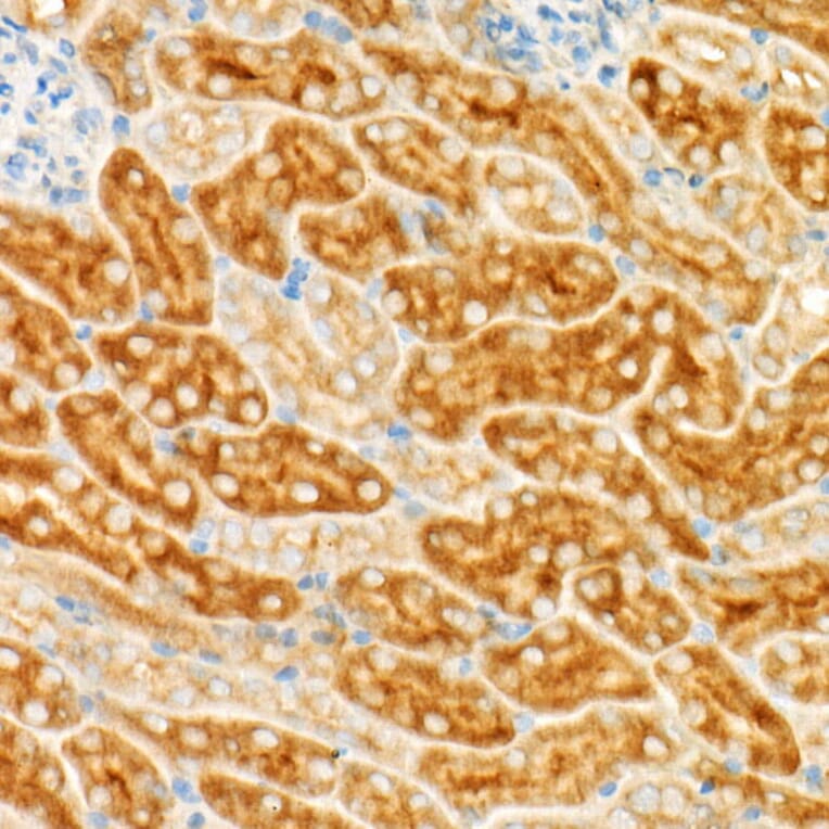 Immunohistochemistry - Anti-GCN2 Antibody [ARC52336] (A306894) - Antibodies.com