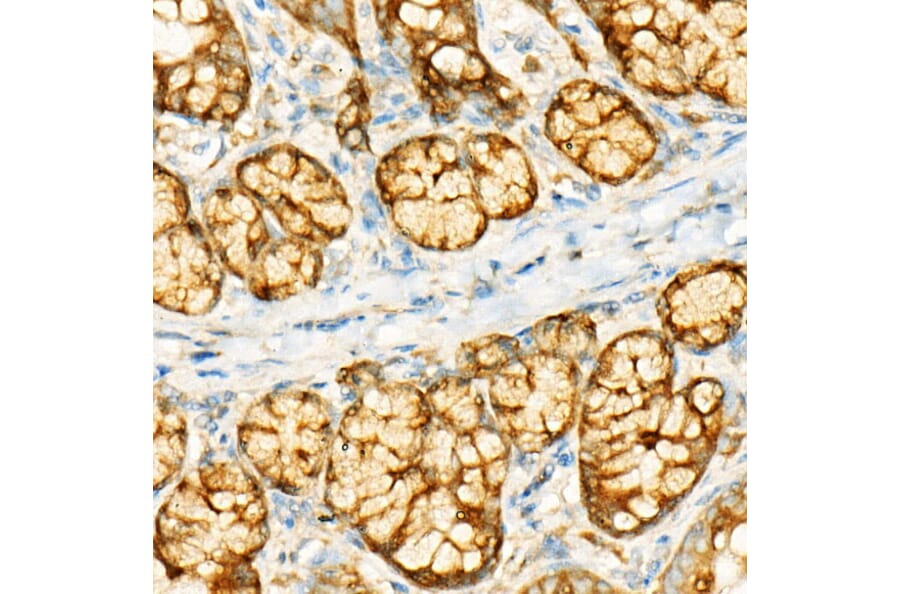 Immunohistochemistry - Anti-GCN2 Antibody [ARC52336] (A306894) - Antibodies.com