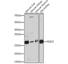 Western Blot - Anti-NQO2 Antibody [ARC0846] (A306896) - Antibodies.com