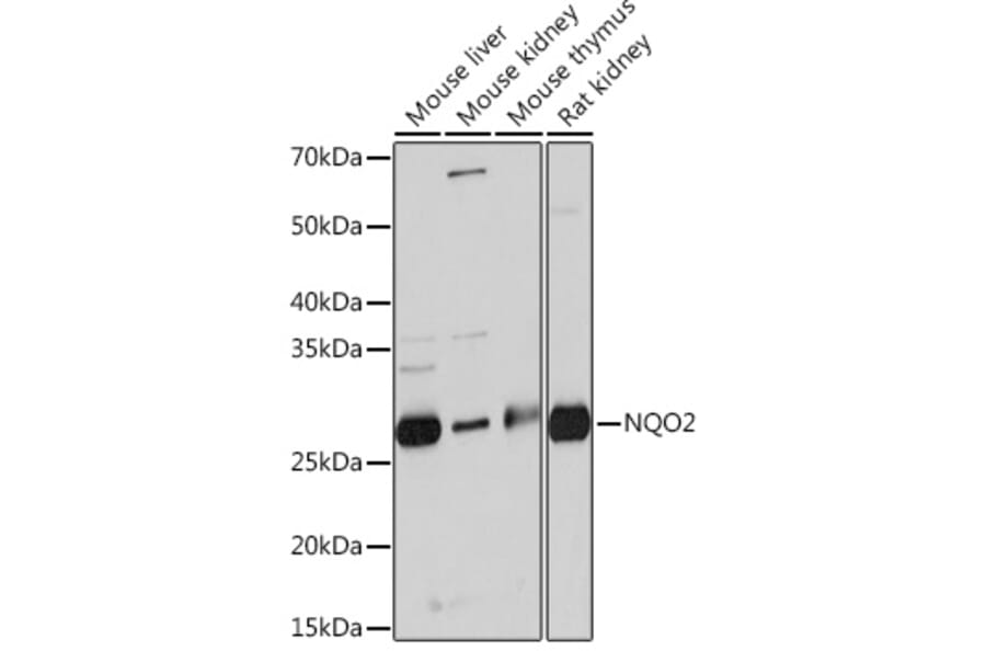 Western Blot - Anti-NQO2 Antibody [ARC0846] (A306896) - Antibodies.com