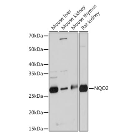 Western Blot - Anti-NQO2 Antibody [ARC0846] (A306896) - Antibodies.com