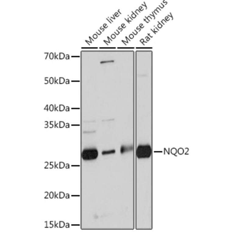 Western Blot - Anti-NQO2 Antibody [ARC0846] (A306896) - Antibodies.com