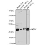 Western Blot - Anti-NQO2 Antibody [ARC0846] (A306896) - Antibodies.com
