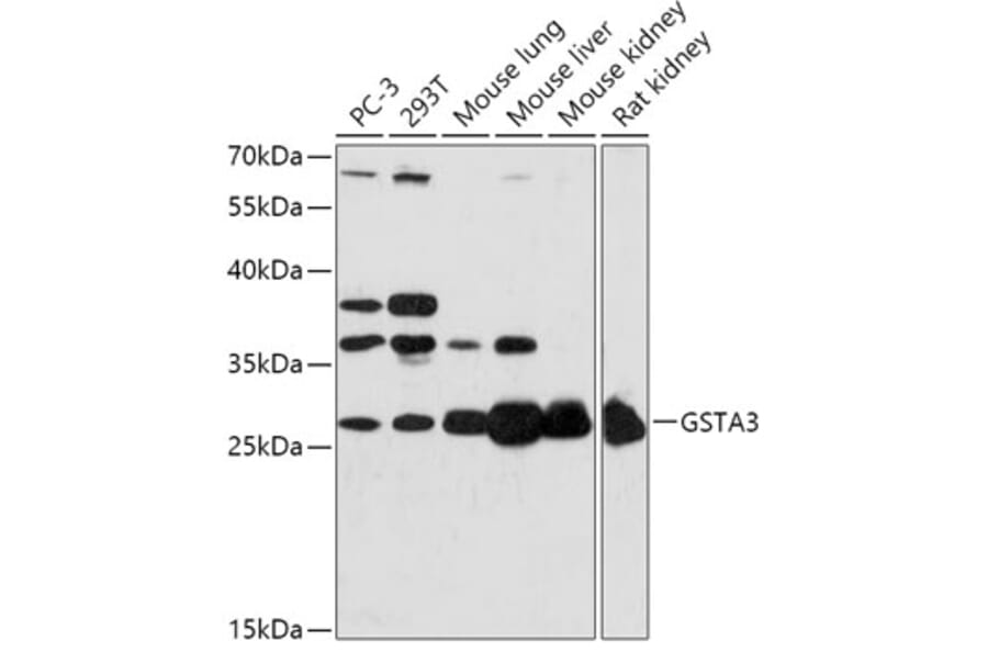Western Blot - Anti-GSTA3 Antibody (A306897) - Antibodies.com
