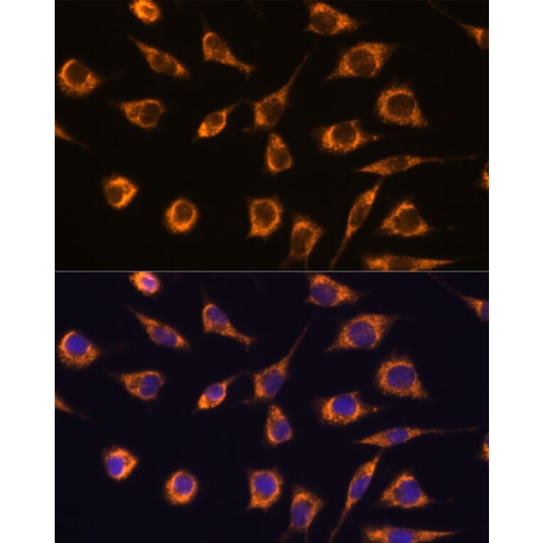 Immunofluorescence - Anti-GSTA3 Antibody (A306897) - Antibodies.com