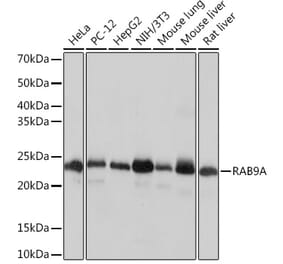 Western Blot - Anti-Rab9 Antibody [ARC0332] (A306898) - Antibodies.com
