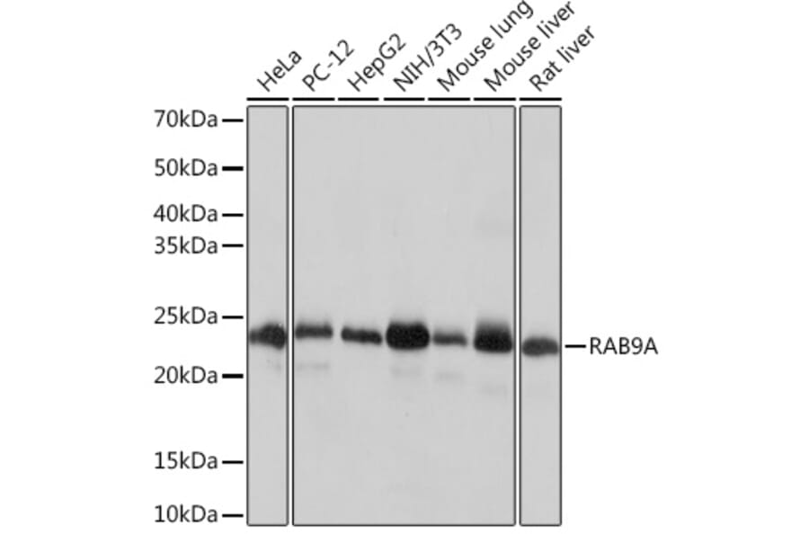 Western Blot - Anti-Rab9 Antibody [ARC0332] (A306898) - Antibodies.com