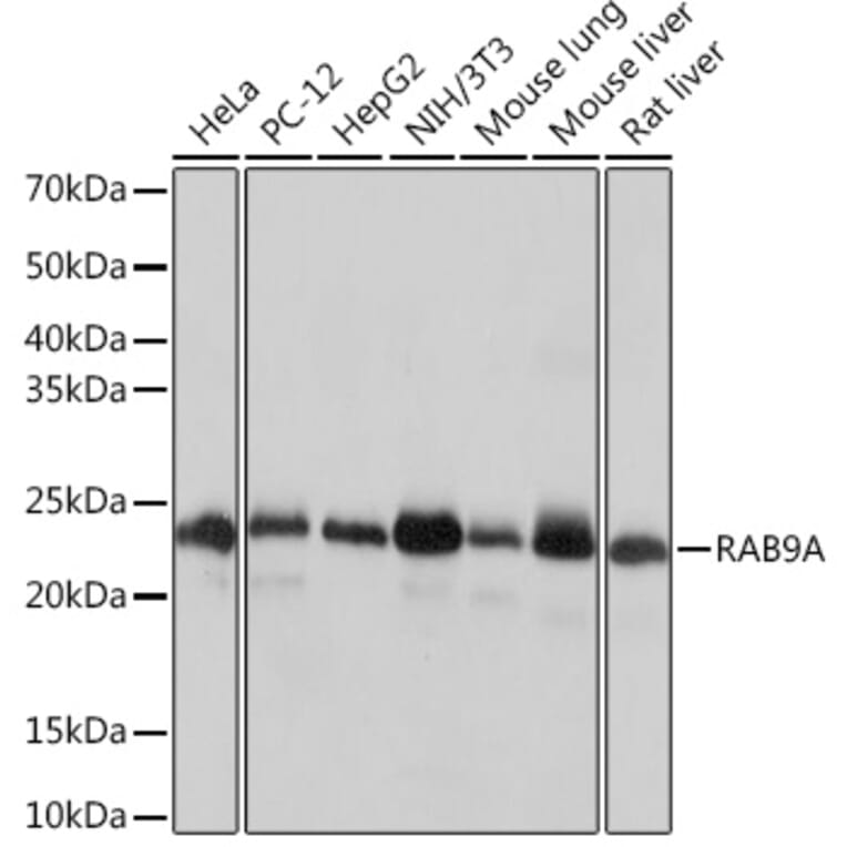 Western Blot - Anti-Rab9 Antibody [ARC0332] (A306898) - Antibodies.com