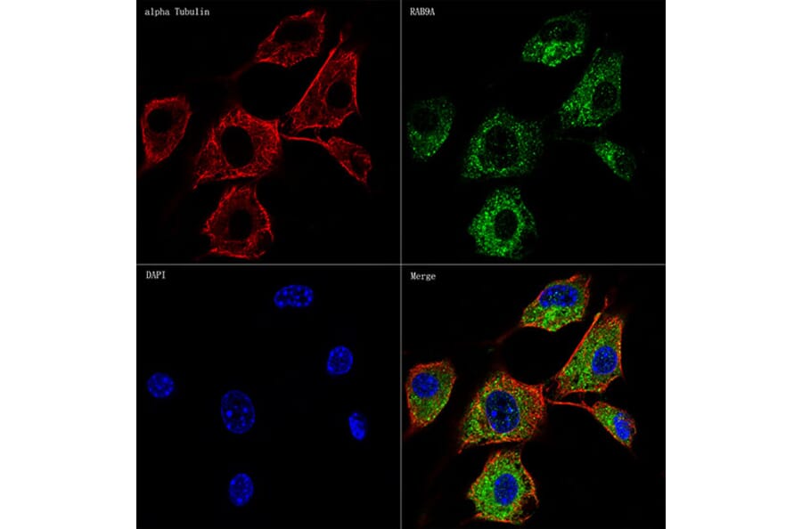 Immunofluorescence - Anti-Rab9 Antibody [ARC0332] (A306898) - Antibodies.com