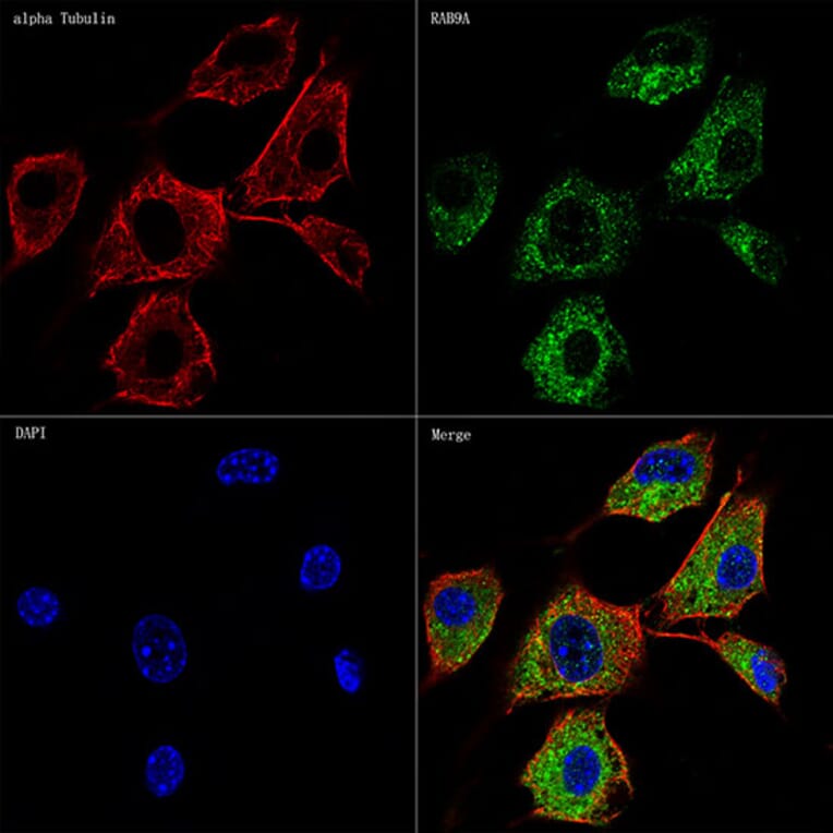Immunofluorescence - Anti-Rab9 Antibody [ARC0332] (A306898) - Antibodies.com