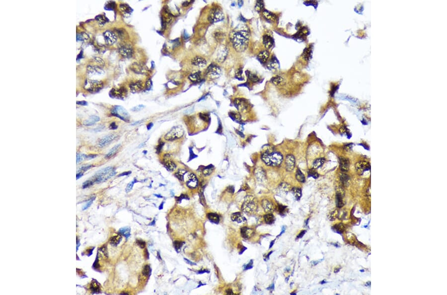 Immunohistochemistry - Anti-Ube2N/Ubc13 Antibody [ARC1495] (A306899) - Antibodies.com