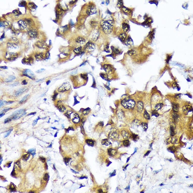 Immunohistochemistry - Anti-Ube2N/Ubc13 Antibody [ARC1495] (A306899) - Antibodies.com