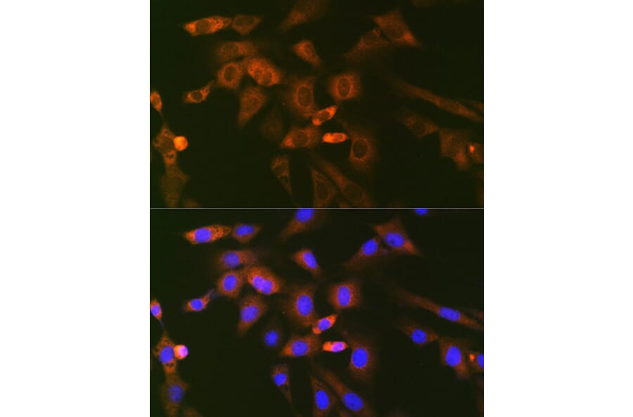 Immunofluorescence - Anti-Ube2N/Ubc13 Antibody [ARC1495] (A306899) - Antibodies.com