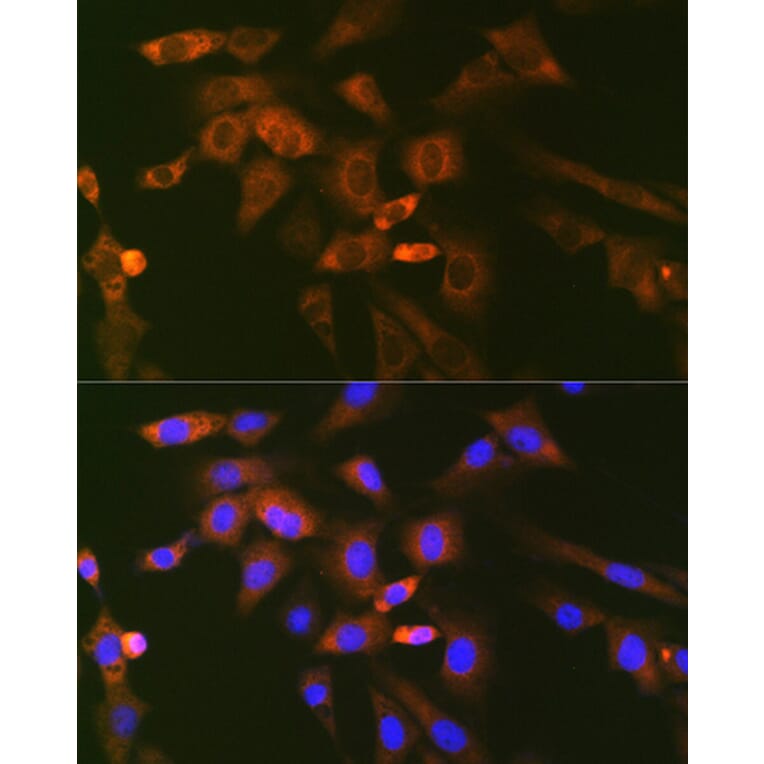 Immunofluorescence - Anti-Ube2N/Ubc13 Antibody [ARC1495] (A306899) - Antibodies.com