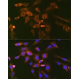 Immunofluorescence - Anti-Ube2N/Ubc13 Antibody [ARC1495] (A306899) - Antibodies.com