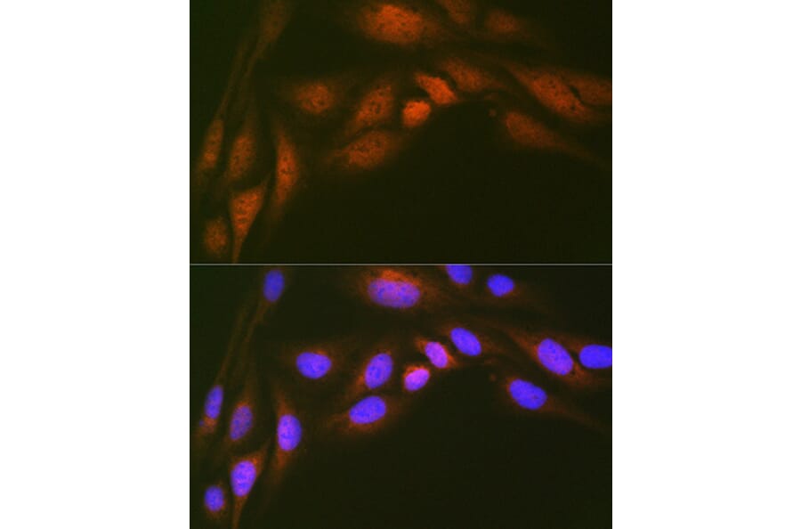 Immunofluorescence - Anti-Ube2N/Ubc13 Antibody [ARC1495] (A306899) - Antibodies.com