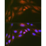 Immunofluorescence - Anti-Ube2N/Ubc13 Antibody [ARC1495] (A306899) - Antibodies.com