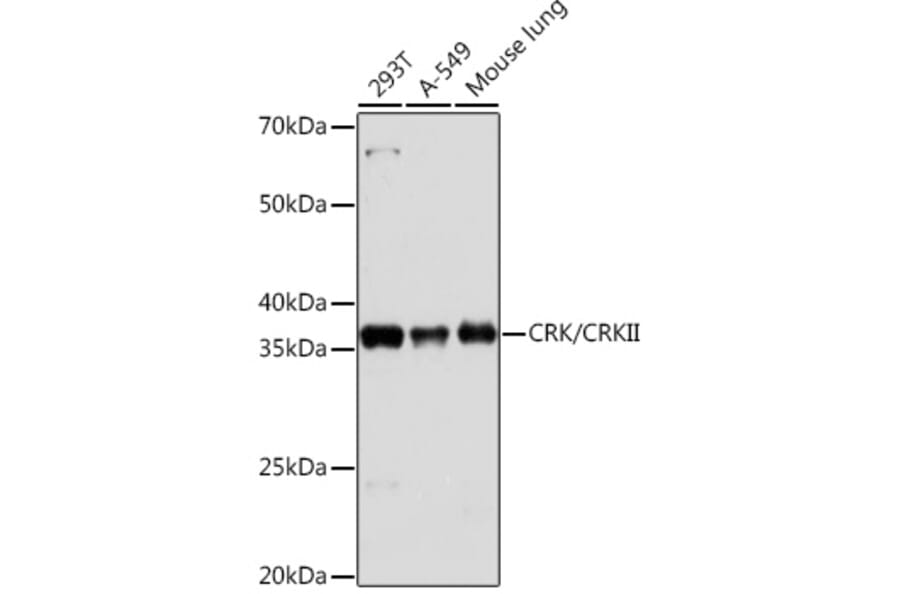 Western Blot - Anti-Crk p38 Antibody [ARC1644] (A306900) - Antibodies.com