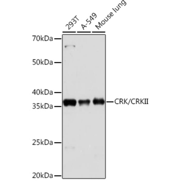 Western Blot - Anti-Crk p38 Antibody [ARC1644] (A306900) - Antibodies.com