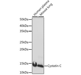 Western Blot - Anti-Cystatin C Antibody [ARC1357] (A306901) - Antibodies.com
