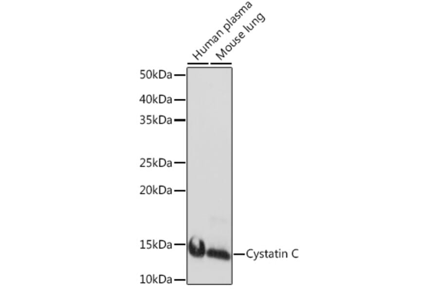 Western Blot - Anti-Cystatin C Antibody [ARC1357] (A306901) - Antibodies.com