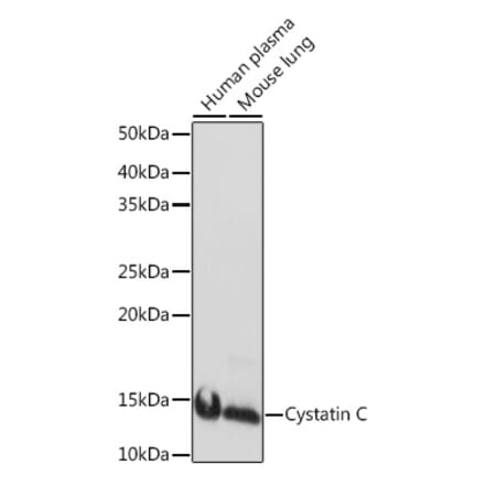 Western Blot - Anti-Cystatin C Antibody [ARC1357] (A306901) - Antibodies.com