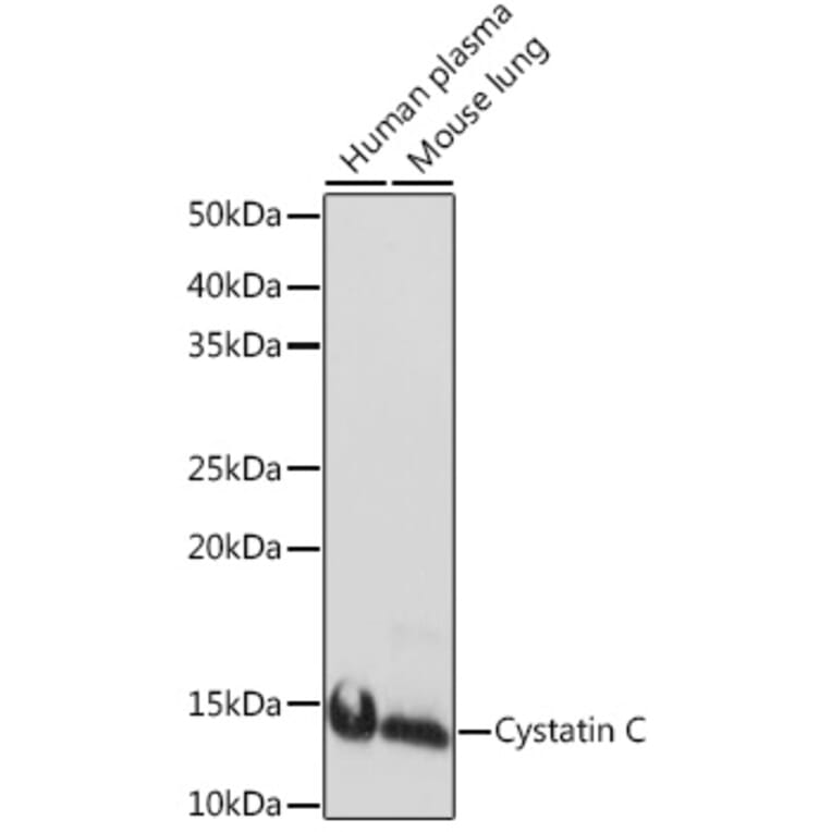 Western Blot - Anti-Cystatin C Antibody [ARC1357] (A306901) - Antibodies.com