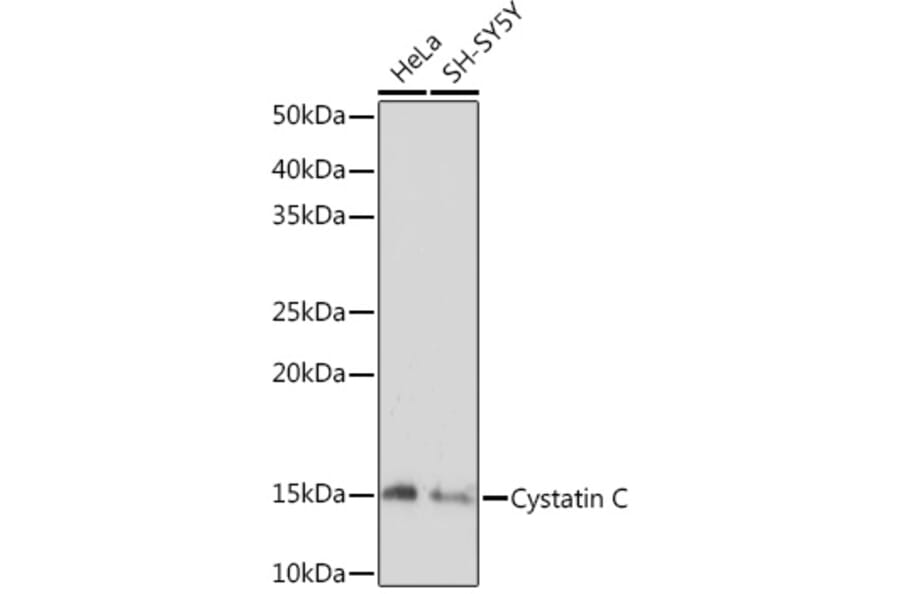 Western Blot - Anti-Cystatin C Antibody [ARC1357] (A306901) - Antibodies.com