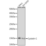 Western Blot - Anti-Cystatin C Antibody [ARC1357] (A306901) - Antibodies.com