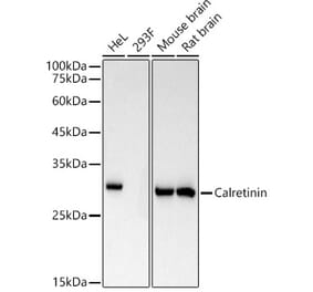Western Blot - Anti-Calretinin Antibody [ARC53573] (A306902) - Antibodies.com
