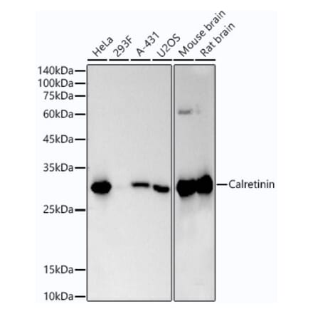 Western Blot - Anti-Calretinin Antibody [ARC53565] (A306903) - Antibodies.com