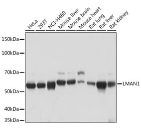 Western Blot - Anti-LMAN1 Antibody [ARC1978] (A306904) - Antibodies.com