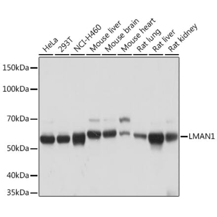 Western Blot - Anti-LMAN1 Antibody [ARC1978] (A306904) - Antibodies.com