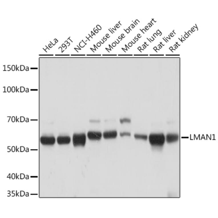 Western Blot - Anti-LMAN1 Antibody [ARC1978] (A306904) - Antibodies.com