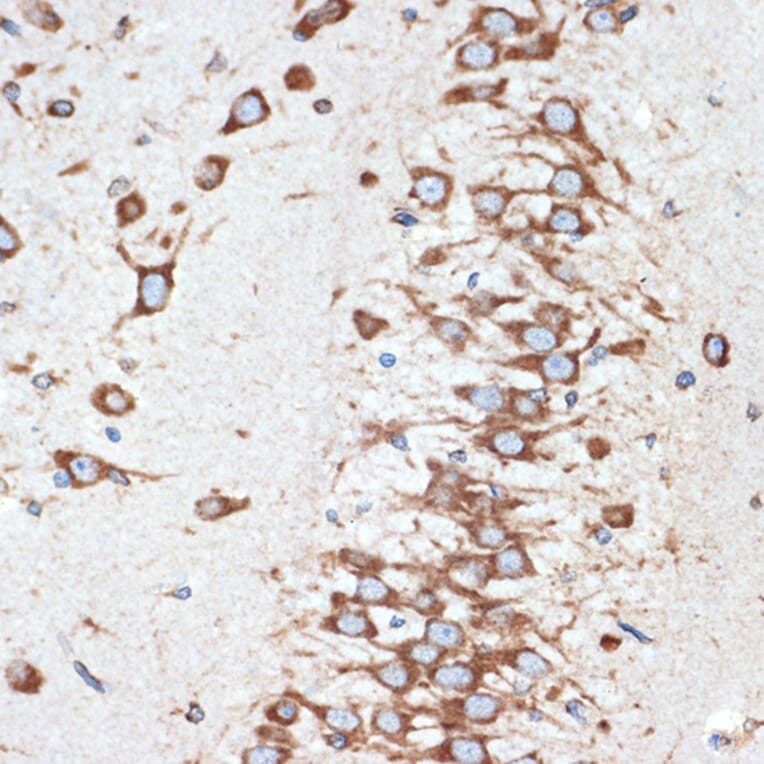 Immunohistochemistry - Anti-LMAN1 Antibody [ARC1978] (A306904) - Antibodies.com