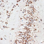 Immunohistochemistry - Anti-LMAN1 Antibody [ARC1978] (A306904) - Antibodies.com