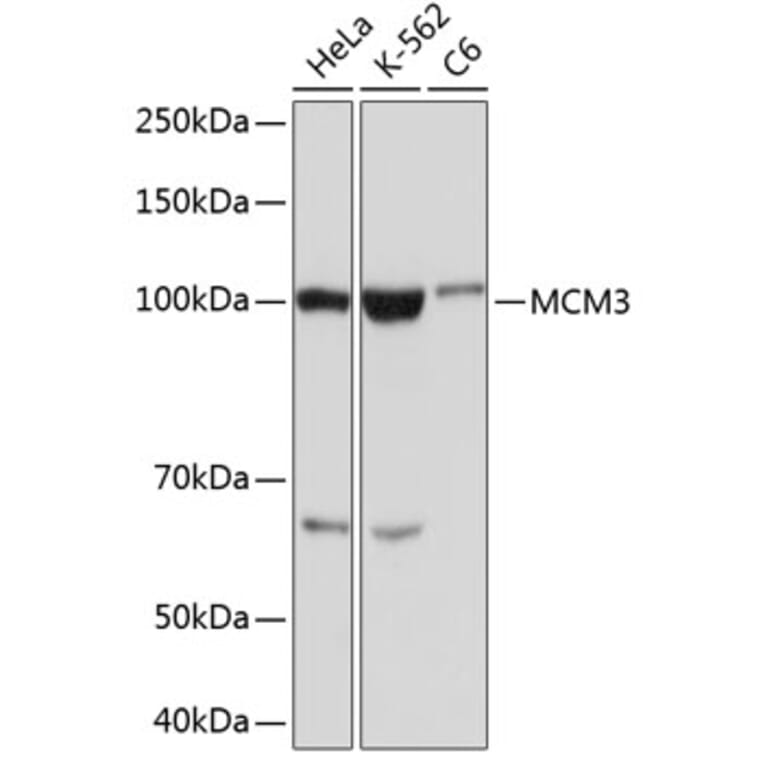 Western Blot - Anti-MCM3 Antibody [ARC0607] (A306905) - Antibodies.com
