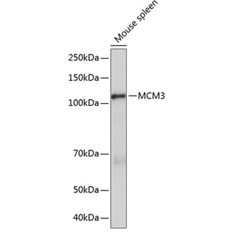Western Blot - Anti-MCM3 Antibody [ARC0607] (A306905) - Antibodies.com