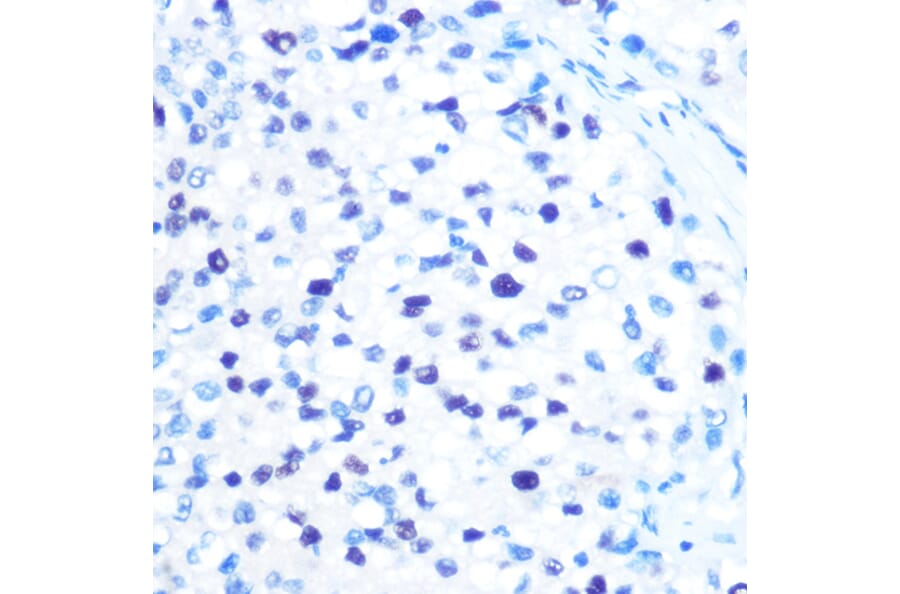 Immunohistochemistry - Anti-MCM3 Antibody [ARC0607] (A306905) - Antibodies.com