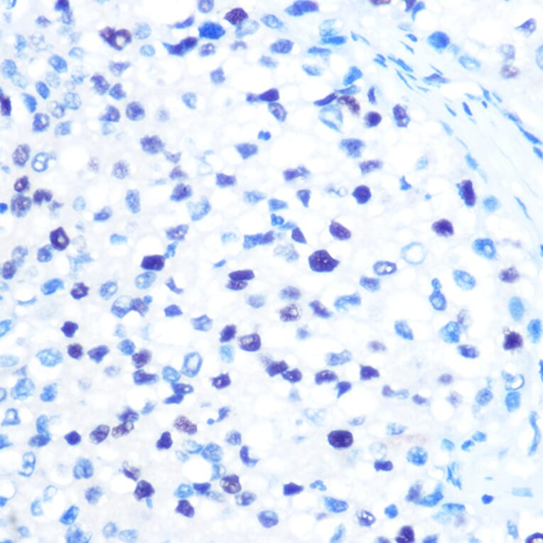 Immunohistochemistry - Anti-MCM3 Antibody [ARC0607] (A306905) - Antibodies.com
