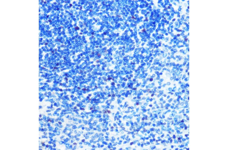 Immunohistochemistry - Anti-MCM3 Antibody [ARC0607] (A306905) - Antibodies.com