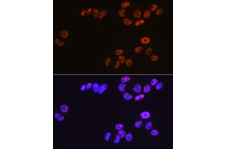 Immunofluorescence - Anti-MCM3 Antibody [ARC0607] (A306905) - Antibodies.com