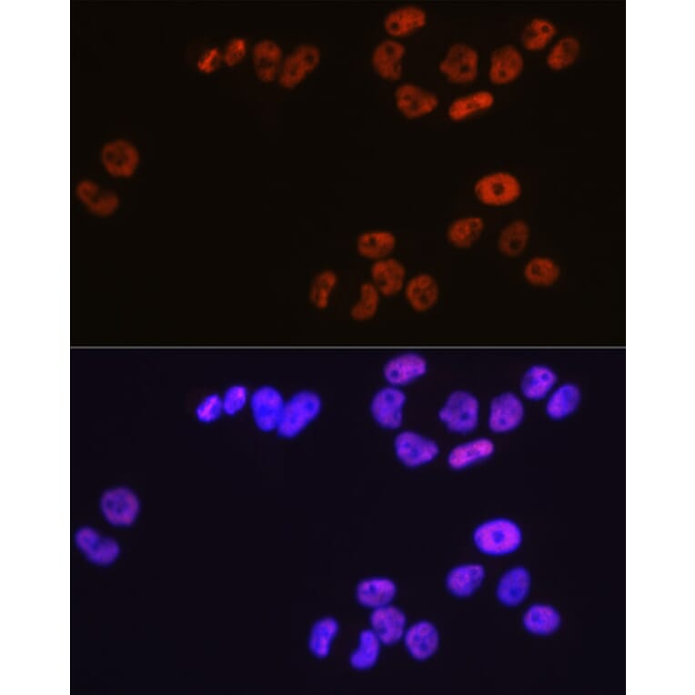 Immunofluorescence - Anti-MCM3 Antibody [ARC0607] (A306905) - Antibodies.com