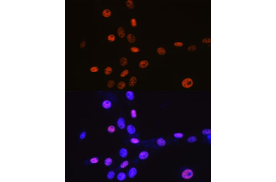 Immunofluorescence - Anti-MCM3 Antibody [ARC0607] (A306905) - Antibodies.com