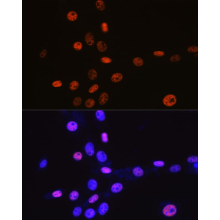 Immunofluorescence - Anti-MCM3 Antibody [ARC0607] (A306905) - Antibodies.com